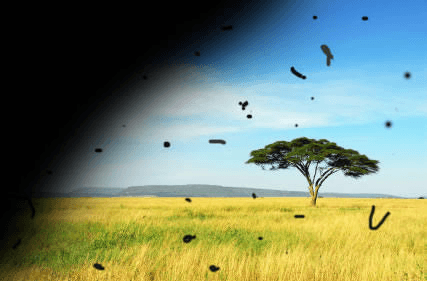 Desprendimiento de Retina