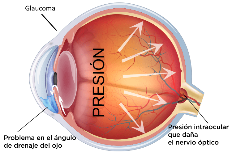 Cirugía de Retina en Buenos Aires