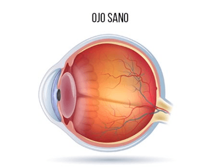 Degeneración Macular: diagnóstico y tratamiento en Buenos Aires